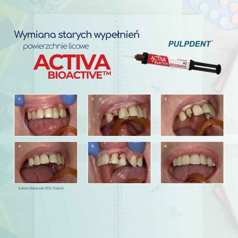 Przykłady zastosowań materiałów‍ bioaktywnych